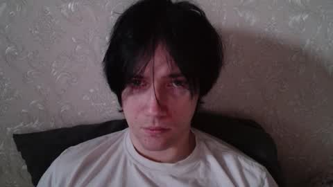 vitiligoboyy online show from 02.03.26