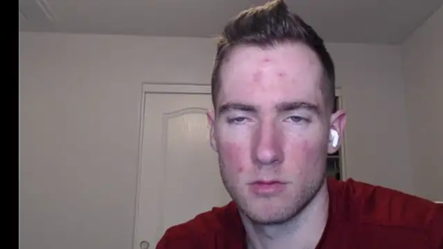 rawdawgrex online show from 03.07.26